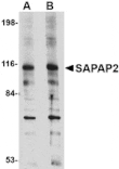 Western blot - SAPAP2 Antibody from Signalway Antibody (24693) - Antibodies.com