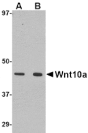 Western blot - Wnt10a Antibody from Signalway Antibody (24699) - Antibodies.com