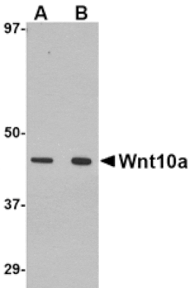 Western blot - Wnt10a Antibody from Signalway Antibody (24699) - Antibodies.com