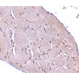 Immunohistochemistry - Wnt10a Antibody from Signalway Antibody (24699) - Antibodies.com