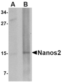 Western blot - Nanos2 Antibody from Signalway Antibody (24702) - Antibodies.com