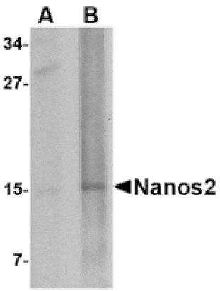 Western blot - Nanos2 Antibody from Signalway Antibody (24702) - Antibodies.com