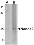 Western blot - Nanos2 Antibody from Signalway Antibody (24702) - Antibodies.com