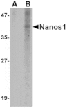 Western blot - Nanos1 Antibody from Signalway Antibody (24714) - Antibodies.com