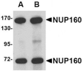 Western blot - NUP160 Antibody from Signalway Antibody (24723) - Antibodies.com