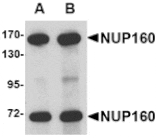 Western blot - NUP160 Antibody from Signalway Antibody (24723) - Antibodies.com