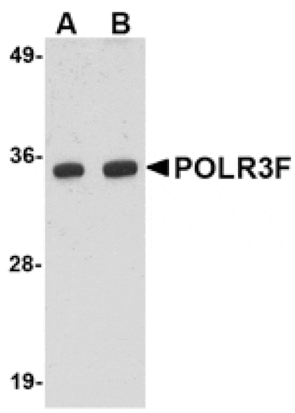 Western blot - POLR3F Antibody from Signalway Antibody (24726) - Antibodies.com