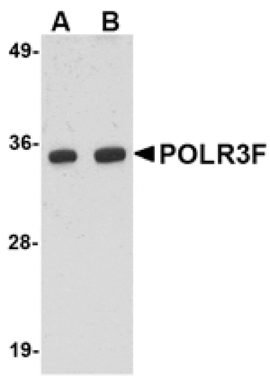 Western blot - POLR3F Antibody from Signalway Antibody (24726) - Antibodies.com