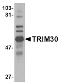 Western blot - TRIM30 Antibody from Signalway Antibody (24732) - Antibodies.com