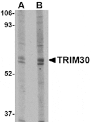 Western blot - TRIM30 Antibody from Signalway Antibody (24733) - Antibodies.com