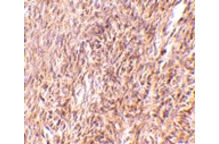 Immunohistochemistry - TRIM30 Antibody from Signalway Antibody (24733) - Antibodies.com