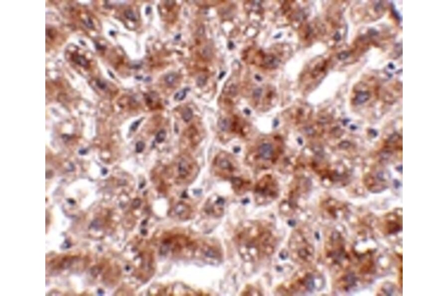 Immunohistochemistry - CUEDC1 Antibody from Signalway Antibody (24766) - Antibodies.com
