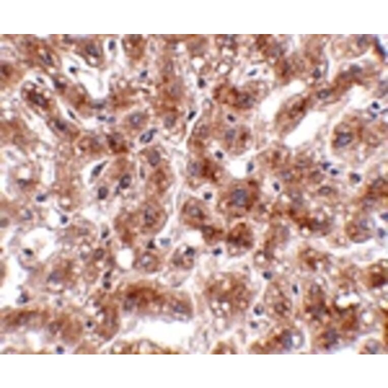 Immunohistochemistry - CUEDC1 Antibody from Signalway Antibody (24766) - Antibodies.com