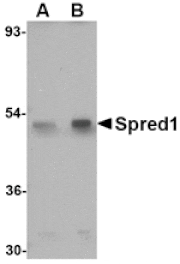 Western blot - Spred1 Antibody from Signalway Antibody (24768) - Antibodies.com