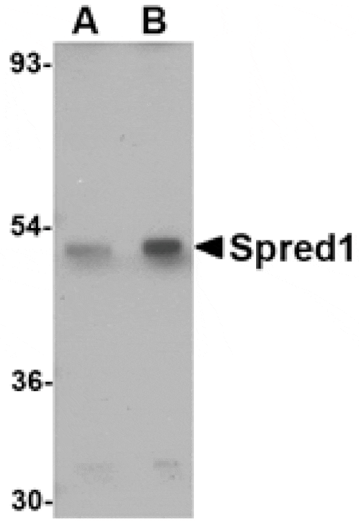 Western blot - Spred1 Antibody from Signalway Antibody (24768) - Antibodies.com