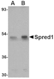 Western blot - Spred1 Antibody from Signalway Antibody (24768) - Antibodies.com