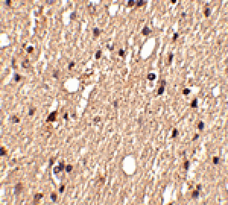 Immunohistochemistry - Spred1 Antibody from Signalway Antibody (24768) - Antibodies.com