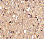 Immunohistochemistry - Spred1 Antibody from Signalway Antibody (24768) - Antibodies.com