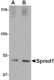 Western blot - Spred1 Antibody from Signalway Antibody (24773) - Antibodies.com