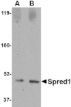 Western blot - Spred1 Antibody from Signalway Antibody (24773) - Antibodies.com