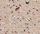 Immunohistochemistry - Spred1 Antibody from Signalway Antibody (24773) - Antibodies.com