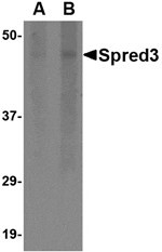 Western blot analysis of Spred3 in human brain tissue lysate with Spred3 antibody at (A) 2 and (B) 4 µg/mL.