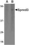 Western blot - Spred3 Antibody from Signalway Antibody (24775) - Antibodies.com