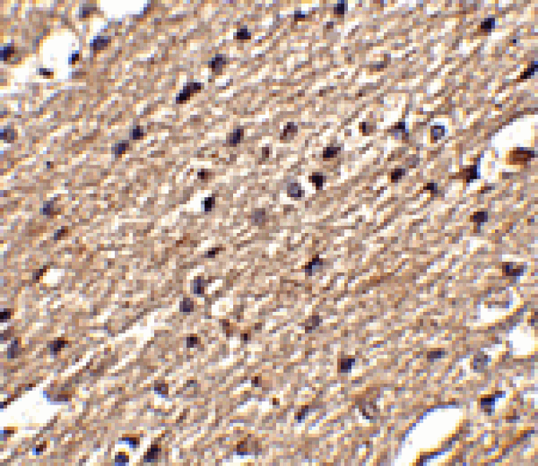 Immunohistochemistry - Spred3 Antibody from Signalway Antibody (24775) - Antibodies.com