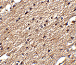 Immunohistochemistry - Spred3 Antibody from Signalway Antibody (24775) - Antibodies.com