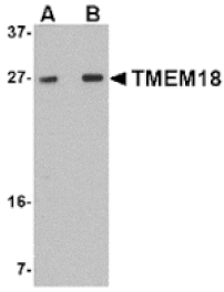 Western blot - TMEM18 Antibody from Signalway Antibody (24842) - Antibodies.com