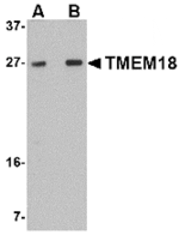 Western blot - TMEM18 Antibody from Signalway Antibody (24842) - Antibodies.com