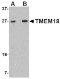 Western blot - TMEM18 Antibody from Signalway Antibody (24842) - Antibodies.com