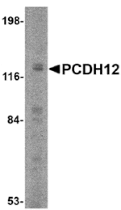 Western blot - PCDH12 Antibody from Signalway Antibody (24854) - Antibodies.com