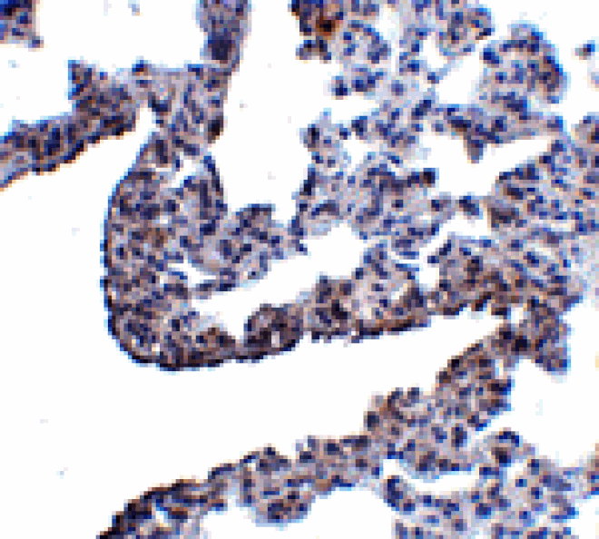 Immunohistochemistry - PCDH12 Antibody from Signalway Antibody (24854) - Antibodies.com