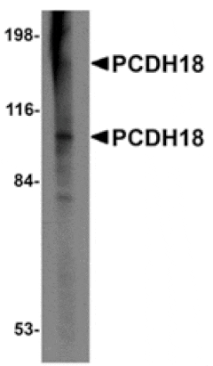 Western blot - PCDH18 Antibody from Signalway Antibody (24859) - Antibodies.com