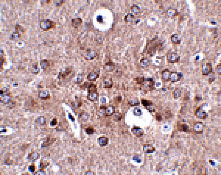Immunohistochemistry - PCDH18 Antibody from Signalway Antibody (24859) - Antibodies.com
