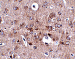 Immunohistochemistry - PCDH18 Antibody from Signalway Antibody (24859) - Antibodies.com