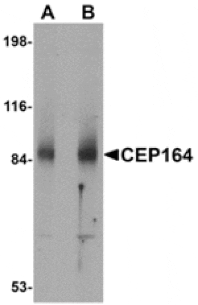 Western blot - CEP164 Antibody from Signalway Antibody (24860) - Antibodies.com