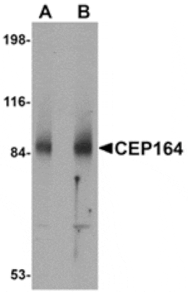 Western blot - CEP164 Antibody from Signalway Antibody (24860) - Antibodies.com