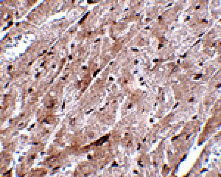 Immunohistochemistry - CEP164 Antibody from Signalway Antibody (24860) - Antibodies.com