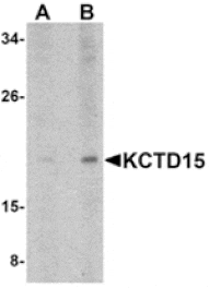Western blot - KCTD15 Antibody from Signalway Antibody (24861) - Antibodies.com