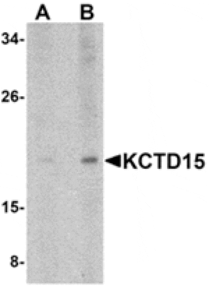 Western blot - KCTD15 Antibody from Signalway Antibody (24861) - Antibodies.com