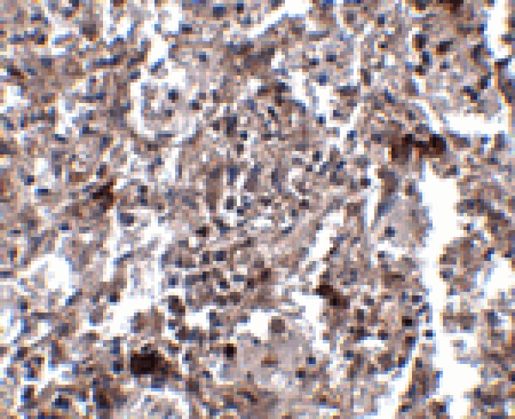 Immunohistochemistry - KCTD15 Antibody from Signalway Antibody (24861) - Antibodies.com