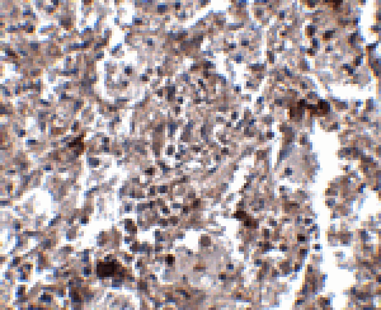 Immunohistochemistry - KCTD15 Antibody from Signalway Antibody (24861) - Antibodies.com