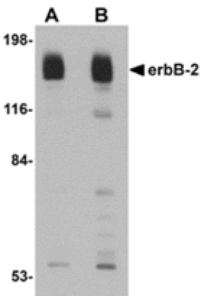 Western blot - erbB-2 Antibody from Signalway Antibody (24888) - Antibodies.com