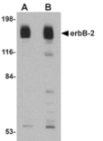 Western blot - erbB-2 Antibody from Signalway Antibody (24888) - Antibodies.com