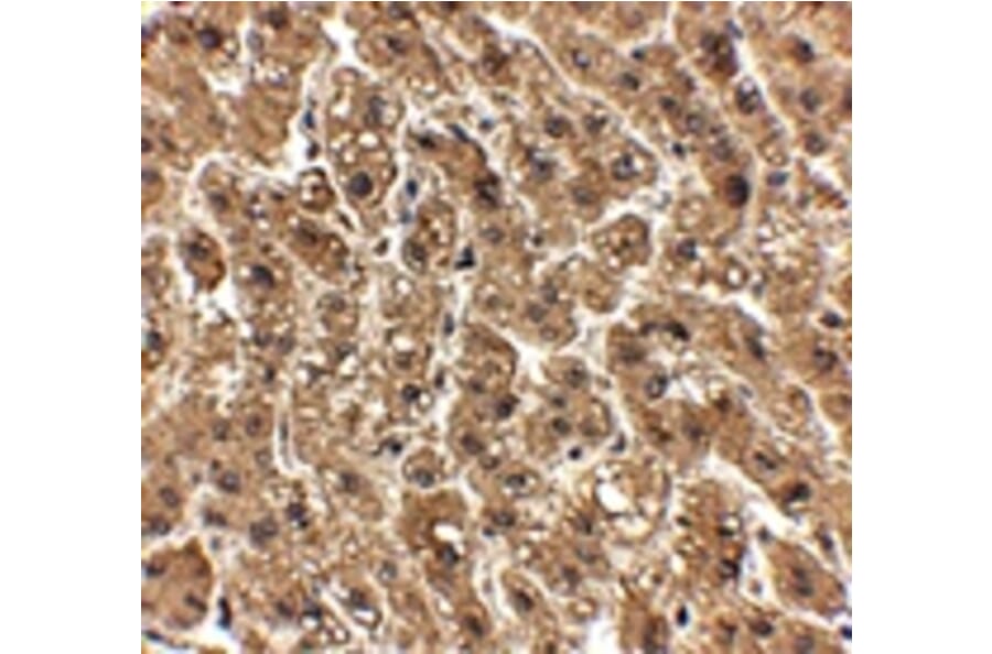 Immunohistochemistry - erbB-2 Antibody from Signalway Antibody (24888) - Antibodies.com