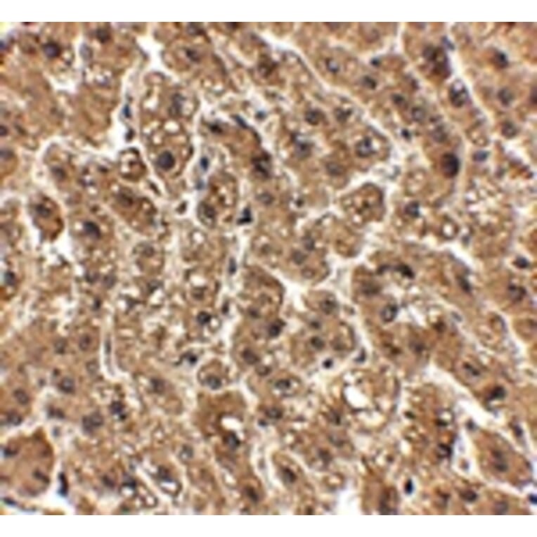 Immunohistochemistry - erbB-2 Antibody from Signalway Antibody (24888) - Antibodies.com