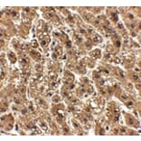Immunohistochemistry - erbB-2 Antibody from Signalway Antibody (24888) - Antibodies.com