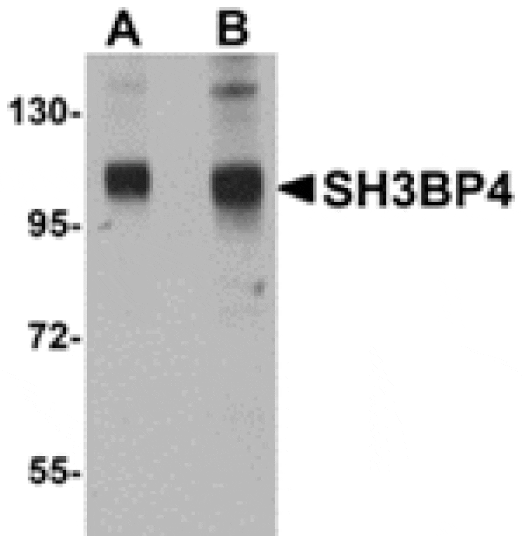 Western blot - SH3BP4 Antibody from Signalway Antibody (24895) - Antibodies.com